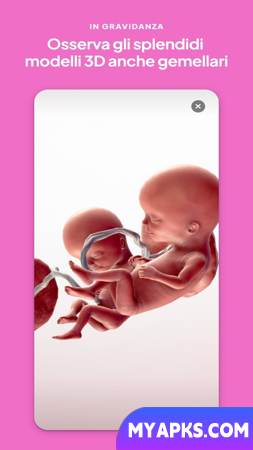 iMamma: Bimbo e Gravidez