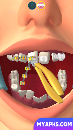 Perfect Smile 3D